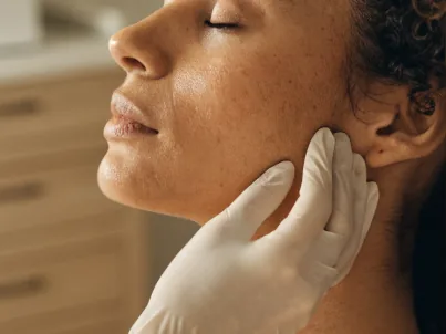 Avaliação da pele do rosto de uma paciente com acne